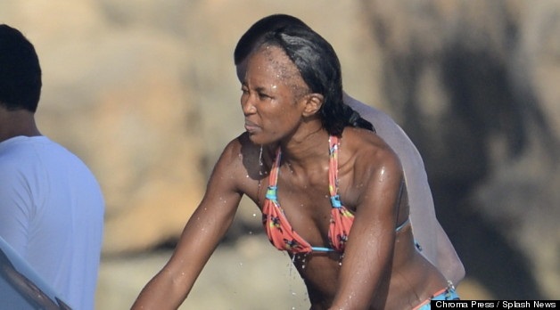 Naomi Campbell Traction Alopecia